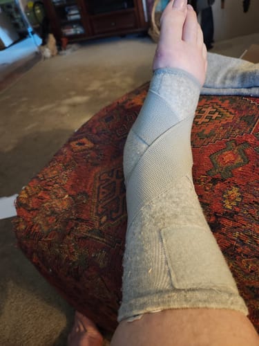 Customer photo review of Premium Bamboo Ankle Support