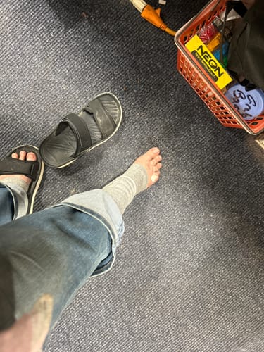 Reviewer's foot wearing the grey Anti-Fatigue Bamboo Footsleeve, shown next to their other foot in a sandal.
