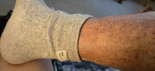 image 2 out of 2: Customer showing a side view of the Premium Bamboo Ankle Support on their leg.