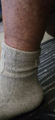 Close-up of a customer wearing the grey Premium Bamboo Ankle Support around their ankle.