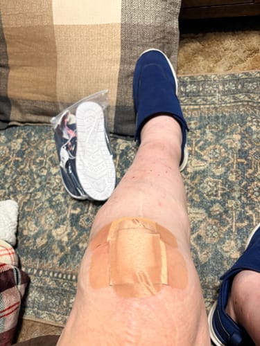 Customer's leg wearing a Premium Bamboo Leg Sleeve, showing a bandage on the knee
