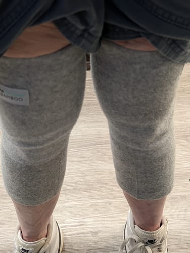 Customer wearing grey Premium Bamboo Knee Sleeves on both knees, with one knee appearing more swollen than the other.